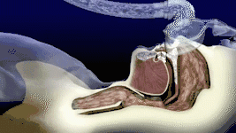 我國3000萬高血壓患者都有這毛??！你知道嗎？